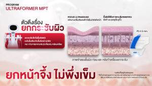Dermatige Aesthetics คลินิกเสริมความงามใกล้ฉัน | Ultraformer III โปรโมชั่นหน้ายุง Prime