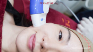 โปรแกรม หน้ายุง Prime โปรแกรมยกหน้าสู้แรงโน้มถ่วงแบบไม่ต้องผ่าตัด