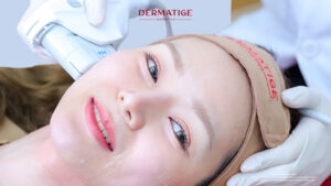 5 ความเชื่อผิดๆ เกี่ยวกับ โปรแกรม Ultherapy PRIME