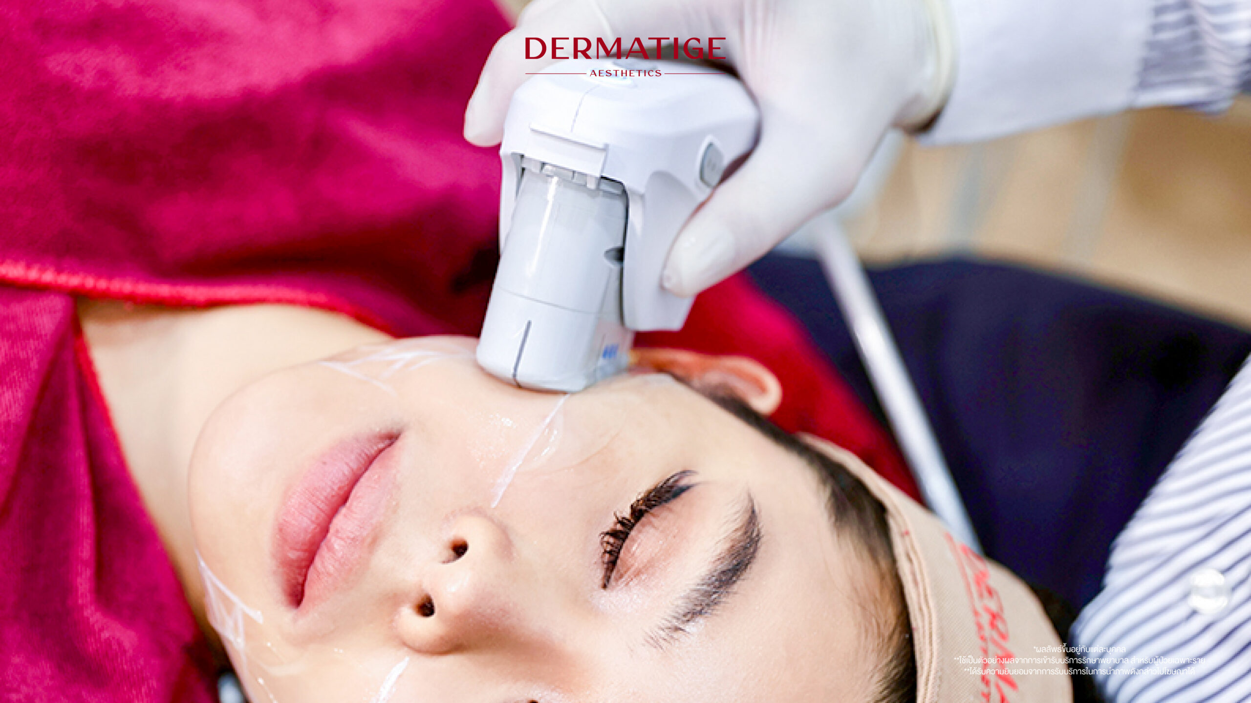 หยุด! 4 ข้อห้ามทำ หลังจบ โปรแกรม Ultherapy PRIME ถ้าไม่อยากให้ผลลัพธ์พัง