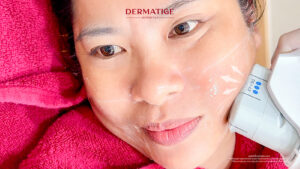 หยุด! 4 ข้อห้ามทำ หลังจบ โปรแกรม Ultherapy PRIME ถ้าไม่อยากให้ผลลัพธ์พัง