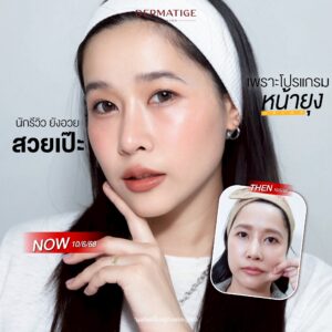 นักรีวิวยังกรี๊ด "โปรแกรมหน้ายุง Prime" ที่ “Dermatige” คือที่สุด ยกกระชับทันใจ ไม่ต้องพักฟื้น