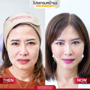 รีวิว Dermartige Aesthetics