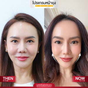 รีวิว Dermartige Aesthetics