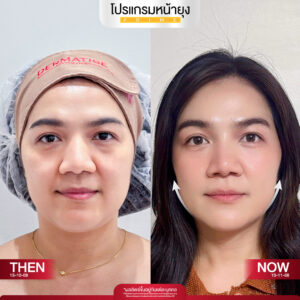 รีวิว Dermartige Aesthetics