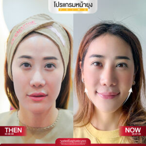 รีวิว Dermartige Aesthetics