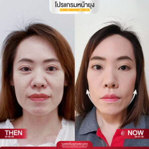 รีวิว Dermartige Aesthetics