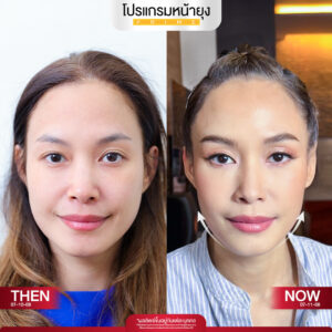 รีวิว Dermartige Aesthetics