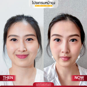 รีวิว Dermartige Aesthetics