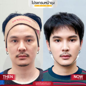 รีวิว Dermartige Aesthetics