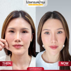 รีวิว Dermartige Aesthetics