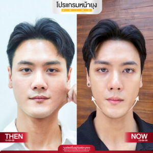 รีวิว Dermartige Aesthetics
