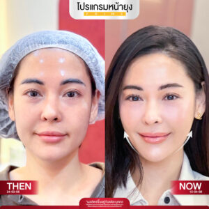รีวิว Dermartige Aesthetics