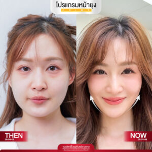 รีวิว Dermartige Aesthetics