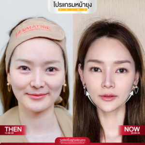 รีวิว Dermartige Aesthetics