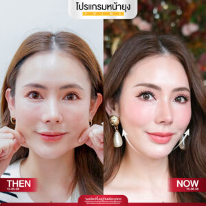 รีวิว Dermartige Aesthetics