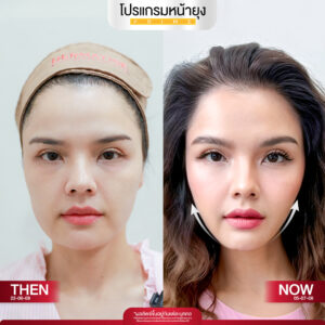 รีวิว Dermartige Aesthetics