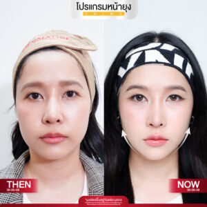 รีวิว Dermartige Aesthetics