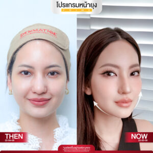 รีวิว Dermartige Aesthetics