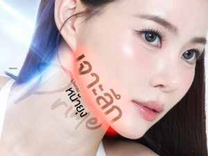 เจาะลึก "โปรแกรมหน้ายุง Prime" คืออะไร? ทำไมถึงเป็นสูตรลับหน้าเรียวที่ Dermatige Aesthetics?
