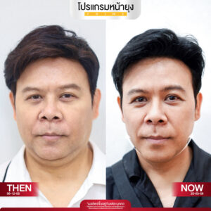 รีวิว Dermartige Aesthetics
