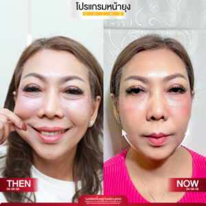 รีวิว Dermartige Aesthetics