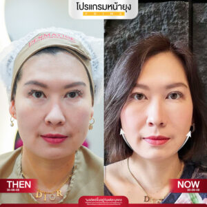 รีวิว Dermartige Aesthetics