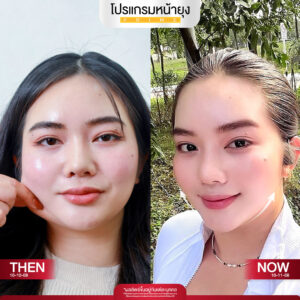 รีวิว Dermartige Aesthetics