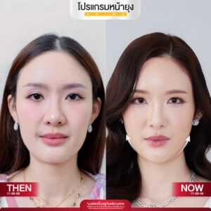 รีวิว Dermartige Aesthetics