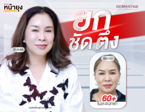 60+ ก็มั่นใจ! คุณนีน่าเลือก “Dermatige” สัมผัสได้ในครั้งแรก “โปรแกรมหน้ายุง Prime” แม่นยำ ตึง ชัด จริง!