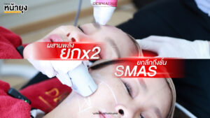 60+ ก็มั่นใจ! คุณนีน่าเลือก “Dermatige” สัมผัสได้ในครั้งแรก “โปรแกรมหน้ายุง Prime” แม่นยำ ตึง ชัด จริง!