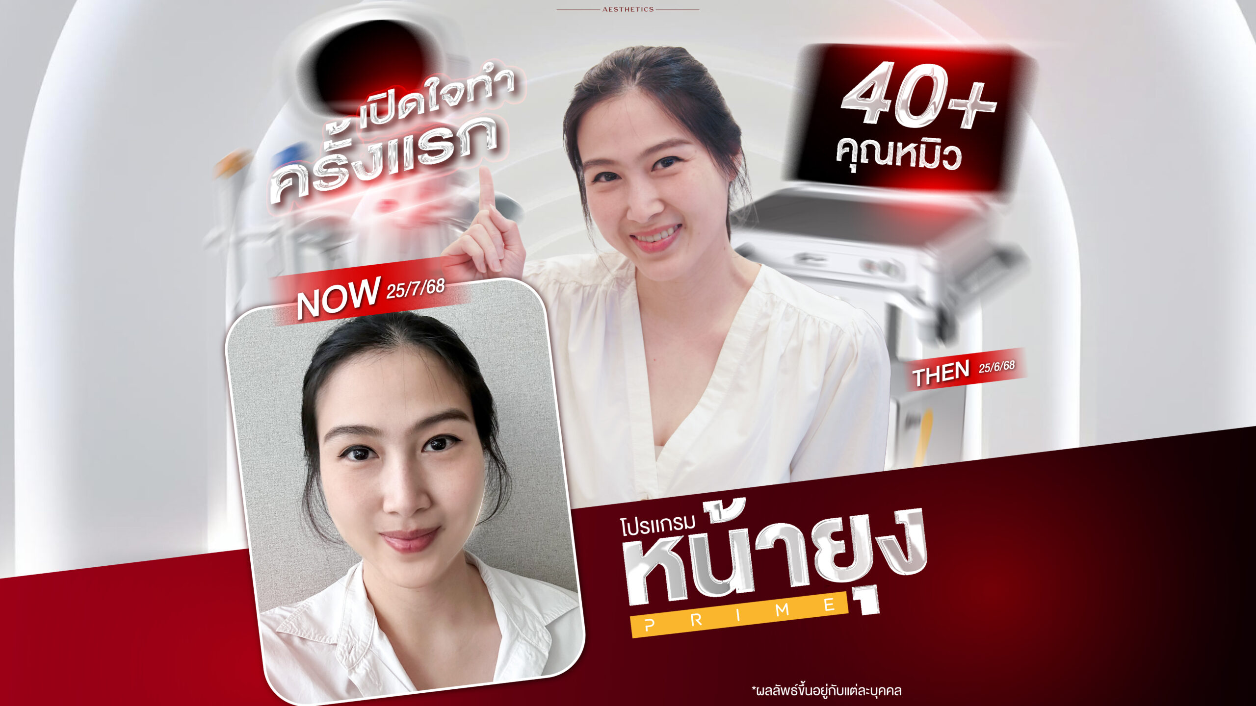 หน้าห้อยหลังคลอดแก้ได้! ส่องรีวิว "โปรแกรมหน้ายุง Prime" หน้ายกจนตกใจ ความเจ็บทนได้ ผลลัพธ์เกินคาด