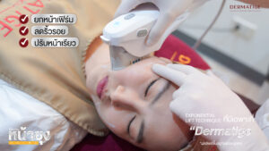 หน้าห้อยหลังคลอดแก้ได้! ส่องรีวิว "โปรแกรมหน้ายุง Prime" หน้ายกจนตกใจ ความเจ็บทนได้ ผลลัพธ์เกินคาด