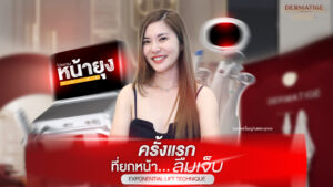 หยุดทุกความเจ็บ! "โปรแกรมหน้ายุง Prime" ที่ “Dermatige” ยกกระชับสุดชิลล์ ผลลัพท์จึ้ง ไม่ต้องพักฟื้น