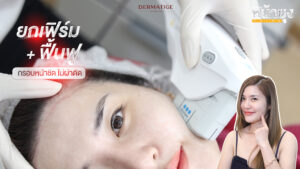 หยุดทุกความเจ็บ! "โปรแกรมหน้ายุง Prime" ที่ “Dermatige” ยกกระชับสุดชิลล์ ผลลัพท์จึ้ง ไม่ต้องพักฟื้น