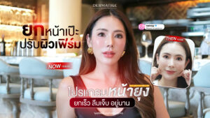 34 แล้วไง "โปรแกรมหน้ายุง Prime" ที่ “Dermatige” ยกชัดเฉพาะจุด แก้มไม่ตอบ
