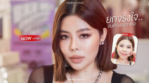หยุดหน้าบาน! เฟียสคอนเฟิร์ม “โปรแกรมหน้ายุง Prime” ที่ “Dermatige” สยามสแควร์ คือที่สุดของความ “วีเชฟ”
