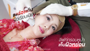 “โปรแกรมหน้ายุง Prime" ที่สุดของความยก ร่องหายวับ คุณอภิการันตี ต้องที่ “Dermatige”