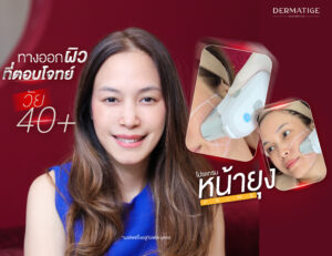 44 ยังเป๊ะ คุณเมย์พิสูจน์ “โปรแกรมหน้ายุง Prime” ที่ “Dermatige” ทางออกของคนไม่สะดวกแก่
