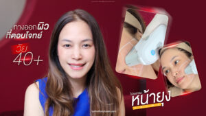 44 ยังเป๊ะ คุณเมย์พิสูจน์ “โปรแกรมหน้ายุง Prime” ที่ “Dermatige” ทางออกของคนไม่สะดวกแก่