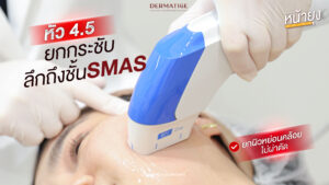 สูตรเจ้าสาว “โปรแกรมหน้ายุง Prime” ที่ “Dermatige” นอนแป๊ปเดียว ตื่นมาหน้ายก แก้มห้อยแก้ได้ในพริบตา