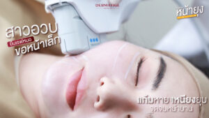 34 แล้วไง "โปรแกรมหน้ายุง Prime" ที่ “Dermatige” ยกชัดเฉพาะจุด แก้มไม่ตอบ