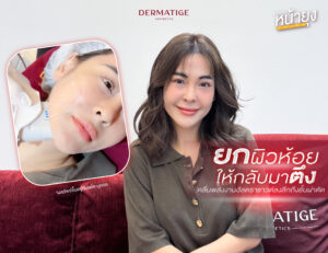 ครั้งแรกในรอบ 45 ปี กับ “โปรแกรมหน้ายุง Prime” ที่ “Dermatige” ถูกใจใช่เลย หน้ายก-เฟิร์มจริง