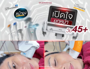 ครั้งแรกในชีวิต คุณแฮม เปิดใจ “โปรแกรมหน้ายุง Prime” ต้นตำรับที่ “Dermatige” ลืมความกลัวไปได้เลย