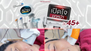 ครั้งแรกในชีวิต คุณแฮม เปิดใจ “โปรแกรมหน้ายุง Prime” ต้นตำรับที่ “Dermatige” ลืมความกลัวไปได้เลย