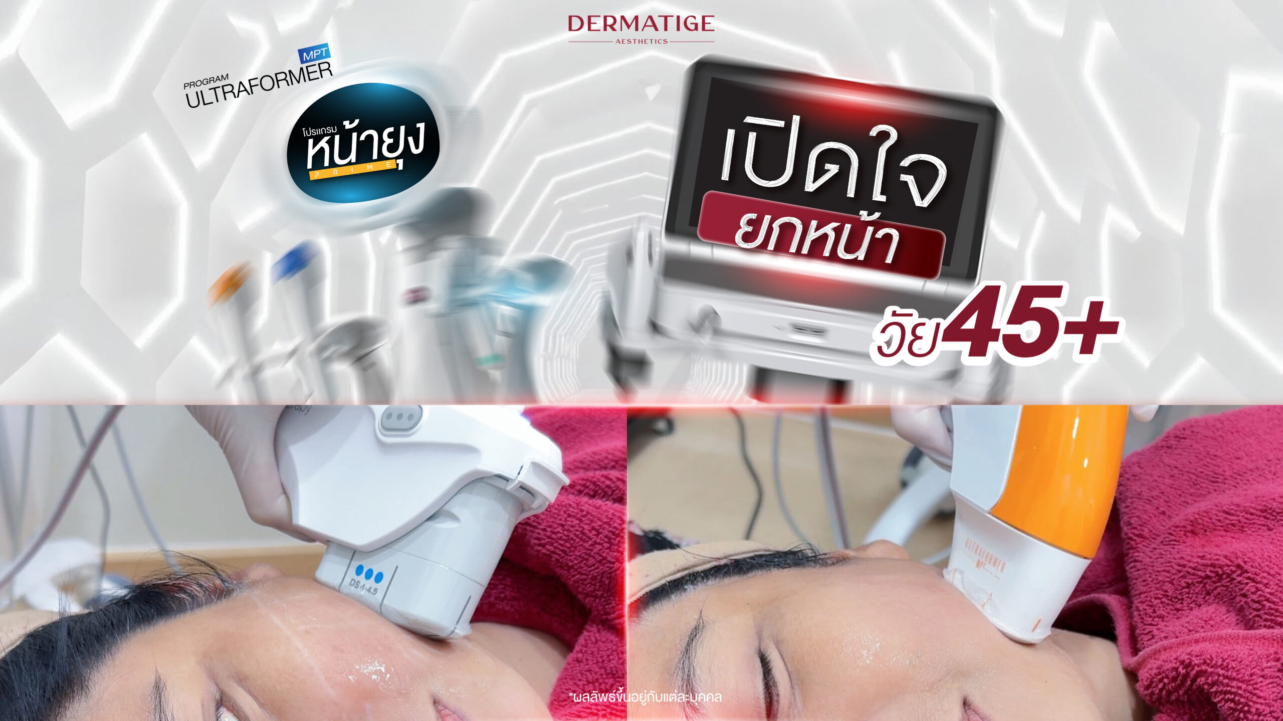 ครั้งแรกในชีวิต คุณแฮม เปิดใจ “โปรแกรมหน้ายุง Prime” ต้นตำรับที่ “Dermatige” ลืมความกลัวไปได้เลย