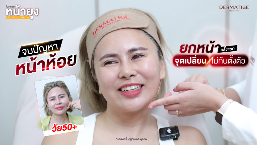 หน้าบาน แก้มห้อย ร่องชัด...ทุกความแก่ แก้ไขได้ด้วย “โปรแกรมหน้ายุง Prime” ที่ “Dermatige” จริงหรือ?