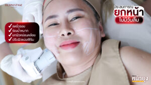 หน้าบาน แก้มห้อย ร่องชัด...ทุกความแก่ แก้ไขได้ด้วย “โปรแกรมหน้ายุง Prime” ที่ “Dermatige” จริงหรือ?