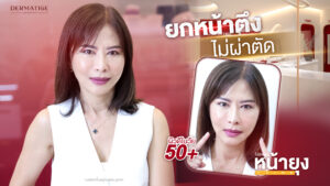 ที่สุดแห่งการบอกต่อจากเพื่อน คุณแอน 40+ พิสูจน์แล้ว “โปรแกรมหน้ายุง Prime” ที่ “Dermatige” ทำแล้วหน้ายกจริง และไม่เจ็บอย่างที่คิด