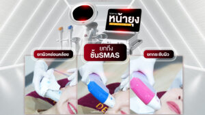 หยุดทุกการค้นหา! เมื่อคุณอัง วัย 40+ ผ่านสมรภูมิยกกระชับทั่งวงการ มั่นใจเลือก “โปรแกรมหน้ายุง Prime” จาก “Dermatige”